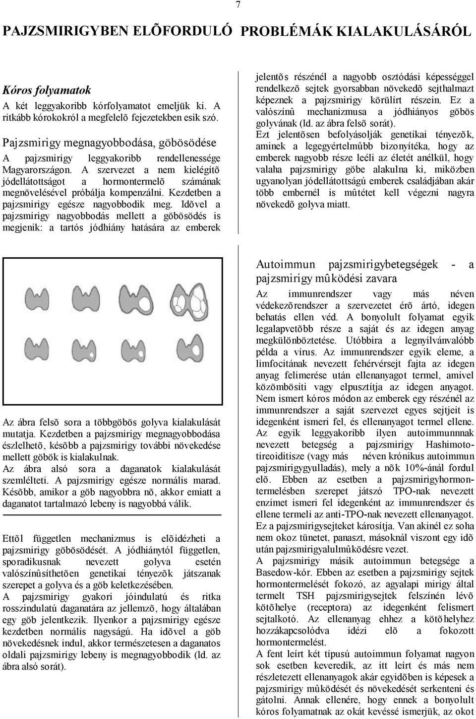 A szervezet a nem kielégítõ jódellátottságot a hormontermelõ számának megnövelésével próbálja kompenzálni. Kezdetben a pajzsmirigy egésze nagyobbodik meg.