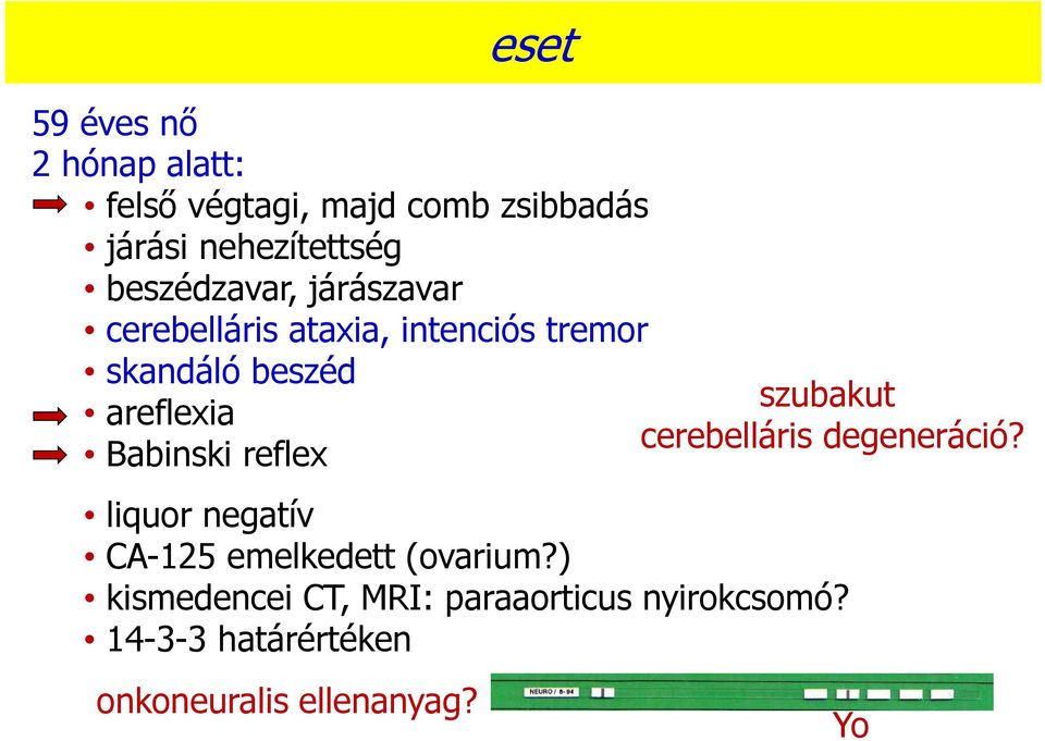 Babinski reflex szubakut diagnózis? cerebelláris degeneráció?