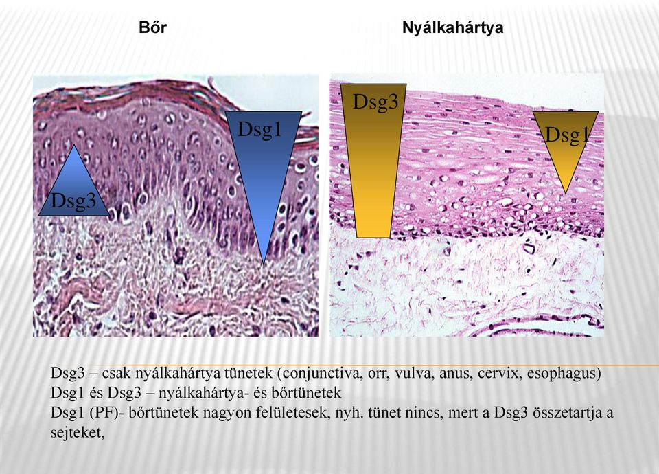 és Dsg3 nyálkahártya- és bőrtünetek Dsg1 (PF)- bőrtünetek