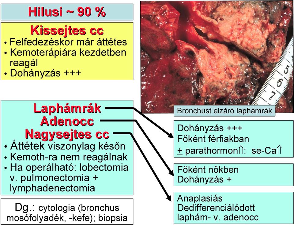 pulmonectomia + lymphadenectomia Dg.