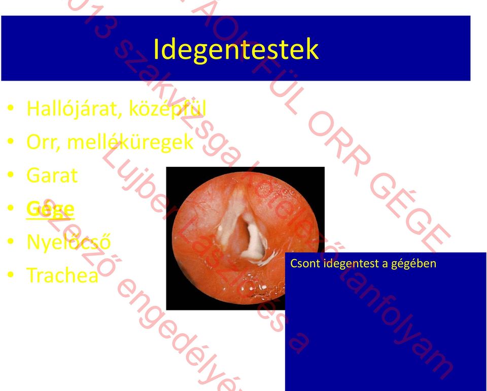 Garat Gége Nyelőcső