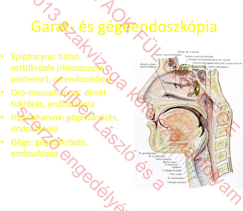 tükrözés, endoszkópia Hypopharynx: gégetükrözés, endoszkópia Gége: gégetükrözés,