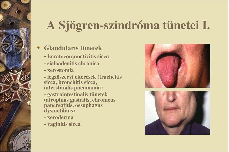 xerostomia - légzıszervi eltérések (tracheitis sicca, bronchitis sicca,