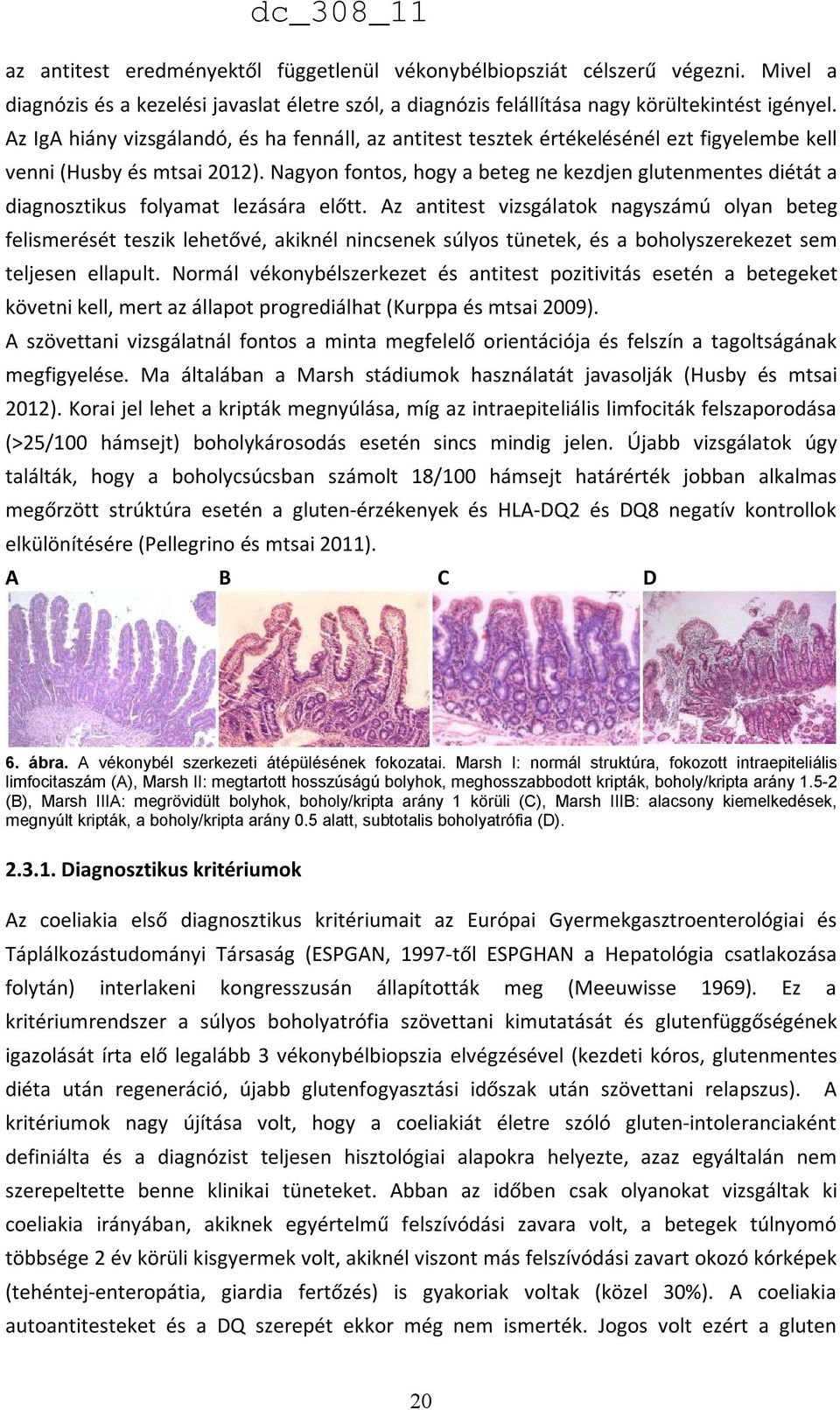 Nagyon fontos, hogy a beteg ne kezdjen glutenmentes diétát a diagnosztikus folyamat lezására előtt.