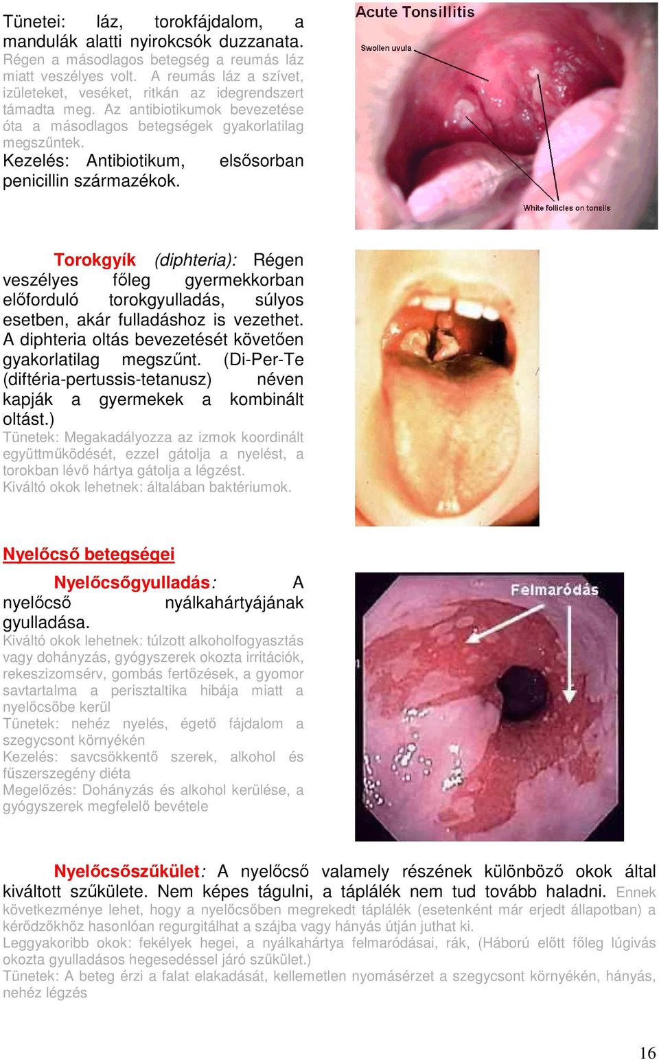 Kezelés: Antibiotikum, penicillin származékok. elsısorban Torokgyík (diphteria): Régen veszélyes fıleg gyermekkorban elıforduló torokgyulladás, súlyos esetben, akár fulladáshoz is vezethet.