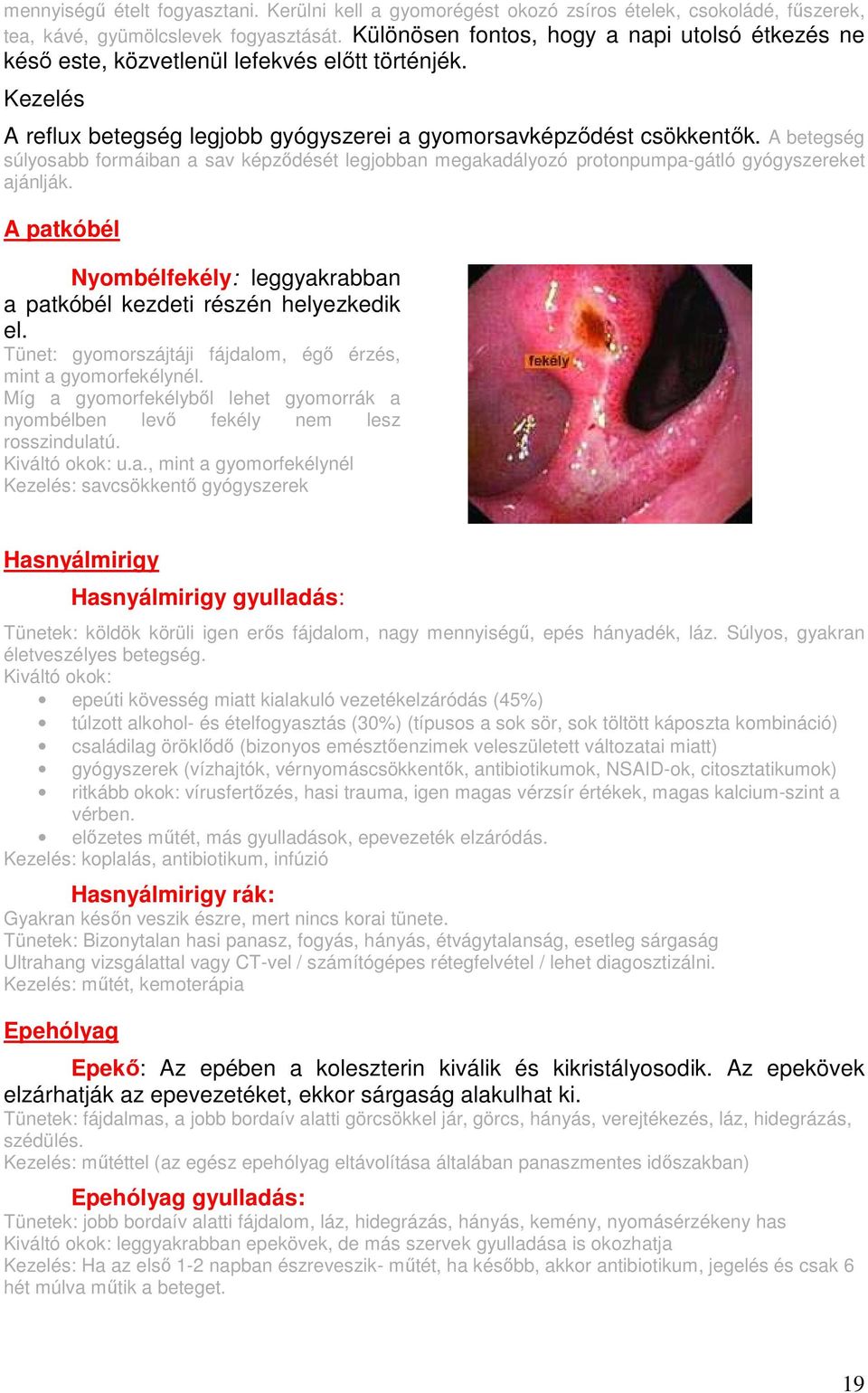 A betegség súlyosabb formáiban a sav képzıdését legjobban megakadályozó protonpumpa-gátló gyógyszereket ajánlják. A patkóbél Nyombélfekély: leggyakrabban a patkóbél kezdeti részén helyezkedik el.