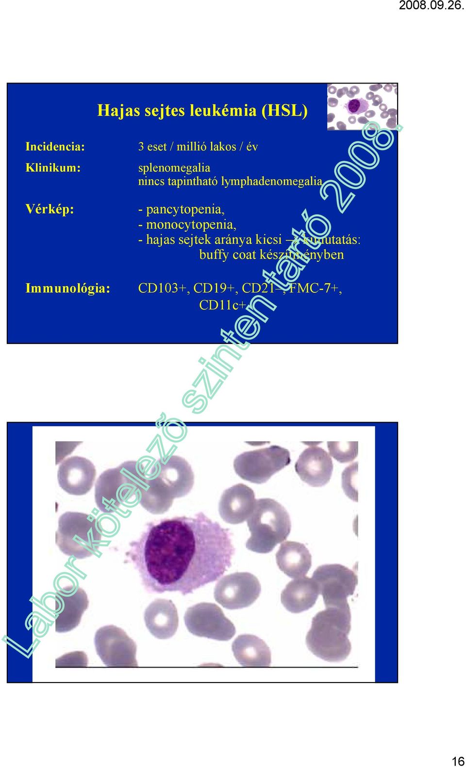 lymphadenomegalia - pancytopenia, - monocytopenia, - hajas sejtek