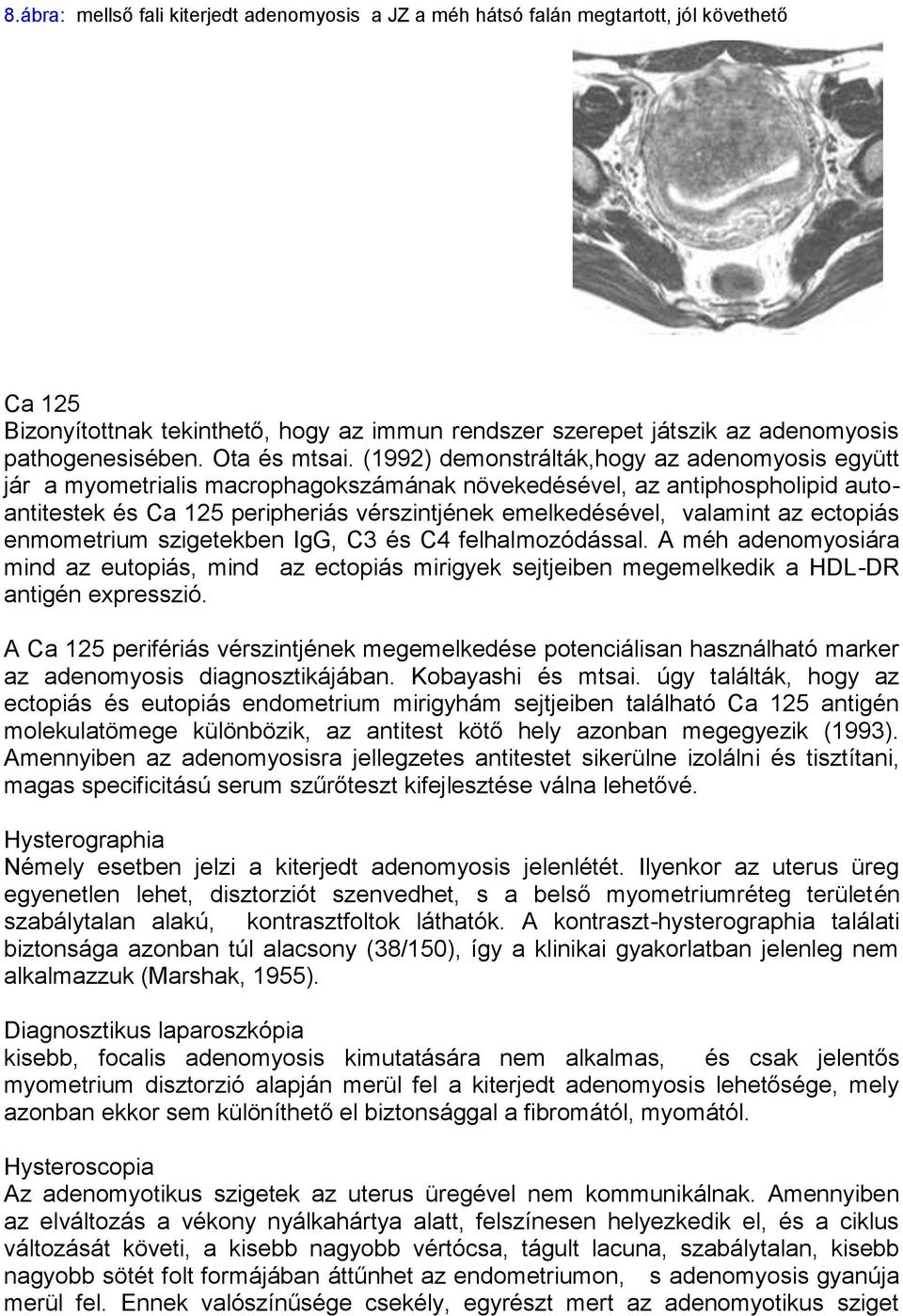 (1992) demonstrálták,hogy az adenomyosis együtt jár a myometrialis macrophagokszámának növekedésével, az antiphospholipid autoantitestek és Ca 125 peripheriás vérszintjének emelkedésével, valamint az