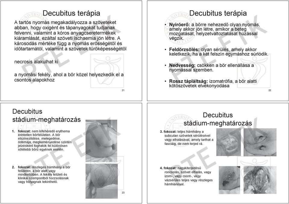 A károsodás mértéke függ a nyomás er sségét l és id tartamától, valamint a szövetek t képességét l necrosis alakulhat ki a nyomási fekély, ahol a b r közel helyezkedik el a csontos alapokhoz 21