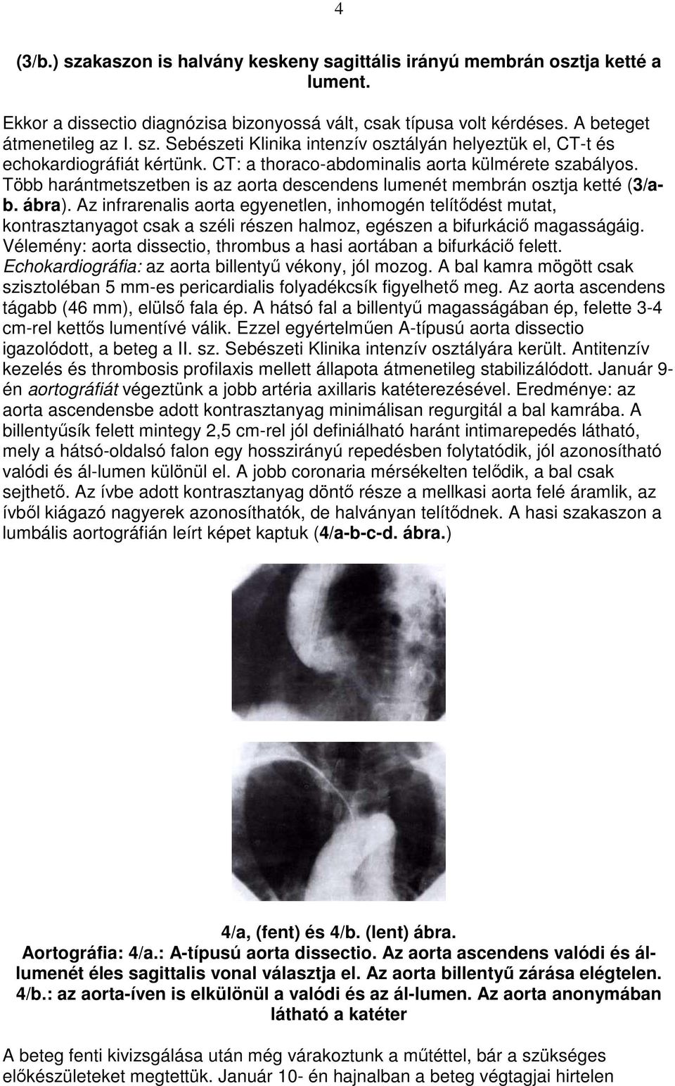 Az infrarenalis aorta egyenetlen, inhomogén telítıdést mutat, kontrasztanyagot csak a széli részen halmoz, egészen a bifurkáciı magasságáig.