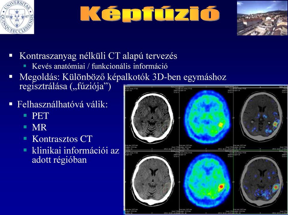 3D-ben egymáshoz regisztrálása ( fúziója ) Felhasználhatóvá