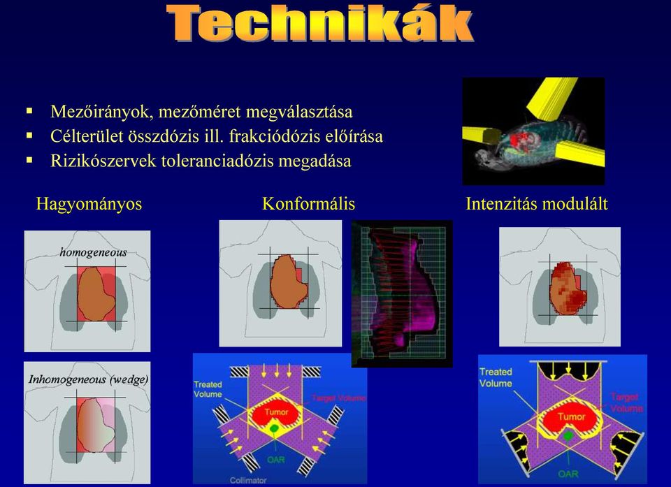 frakciódózis előírása Rizikószervek