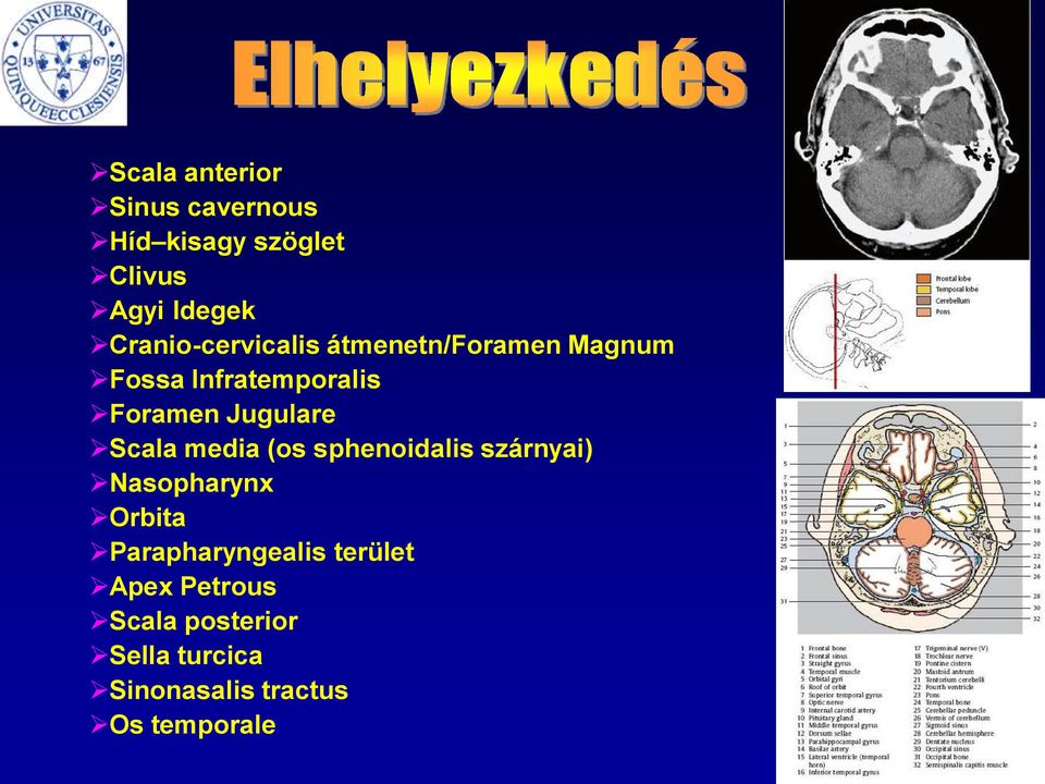 Jugulare Scala media (os sphenoidalis szárnyai) Nasopharynx Orbita