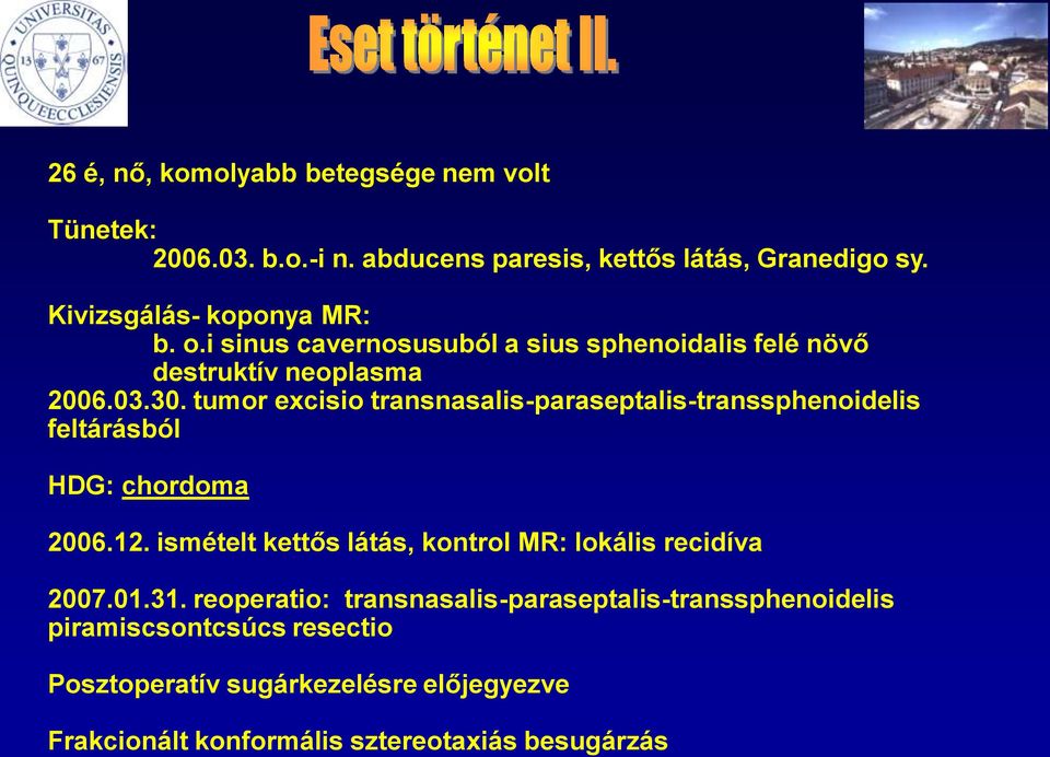 tumor excisio transnasalis-paraseptalis-transsphenoidelis feltárásból HDG: chordoma 2006.12.