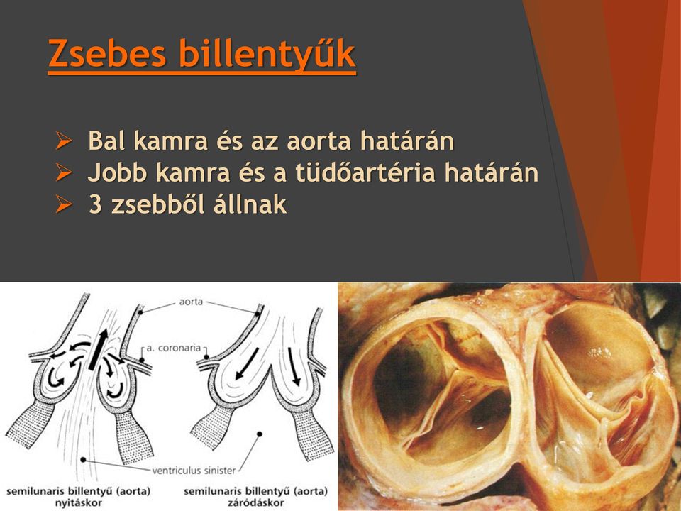 határán Jobb kamra és a