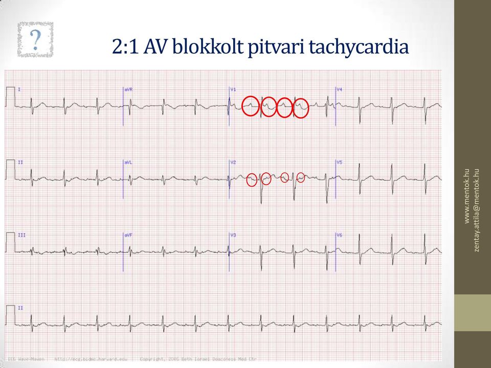 pitvari