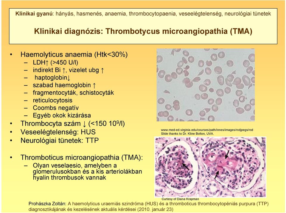 Thrombocyta szám (<150 10 9 /l) Veseelégtelenség: HUS Neurológiai tünetek: TTP www.med-ed.virginia.edu/courses/path/innes/images/rcdjpegs/rcd Slide thanks to Dr.