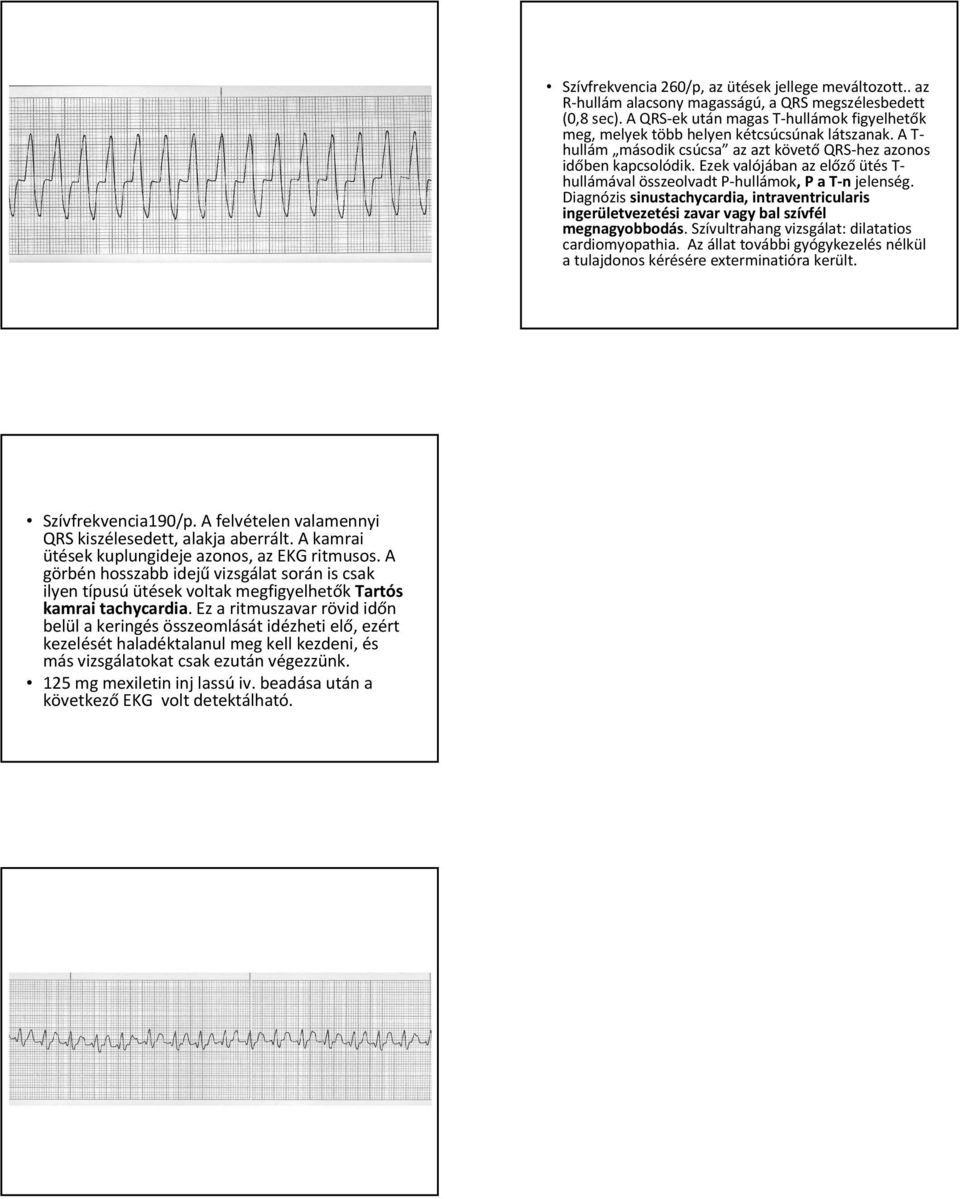 Ez a ritmuszavar rövid időn belül a keringés összeomlását idézheti elő, ezért kezelését haladéktalanul meg kell kezdeni, és más vizsgálatokat csak ezután végezzünk. 125 mg mexiletininjlassúiv.