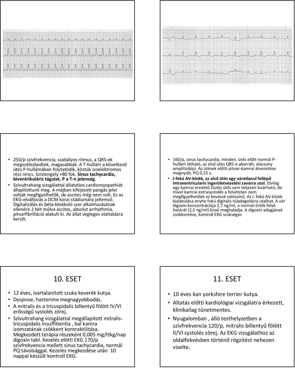 A májban kifejezett pangás jelei voltak megfigyelhetők, de ascitesmég nem volt. Ez az EKG-elváltozás a DCM korai stádiumára jellemző.