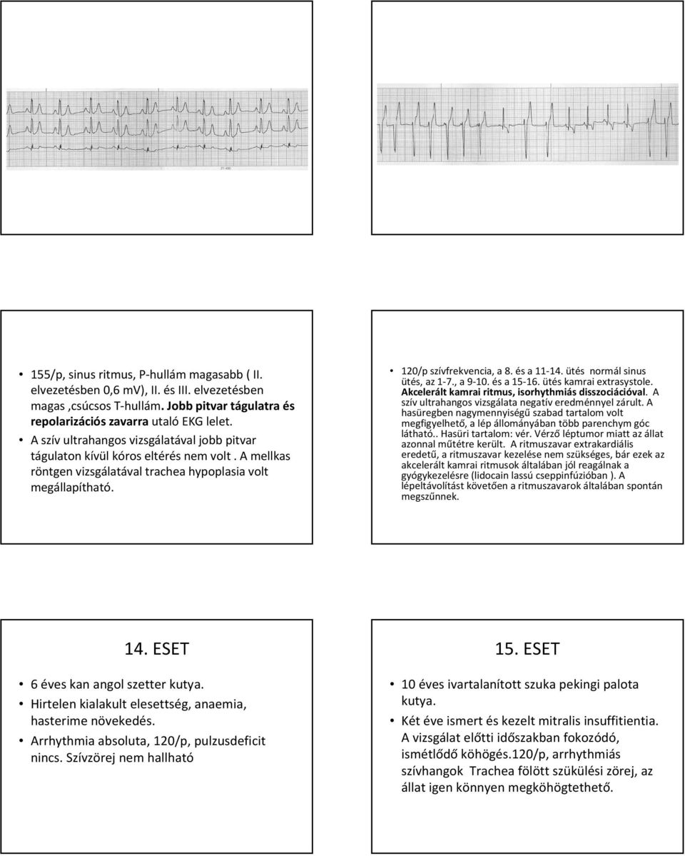 ütés normál sinus ütés, az 1-7., a 9-10. és a 15-16. ütés kamrai extrasystole. Akceleráltkamrai ritmus, isorhythmiásdisszociációval. A szív ultrahangos vizsgálata negatív eredménnyel zárult.