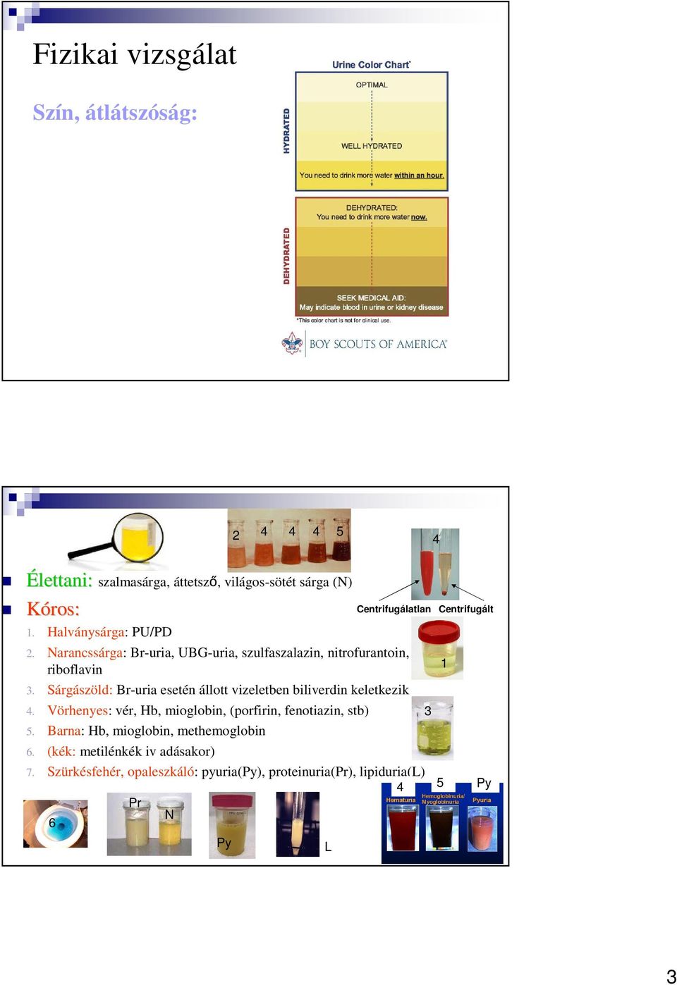 Sárgászöld: Br-uria esetén állott vizeletben biliverdin keletkezik 4. Vörhenyes: vér, Hb, mioglobin, (porfirin, fenotiazin, stb) 5.