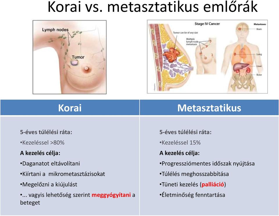 Daganatot eltávolítani Kiírtani a mikrometasztázisokat Megelőzni a kiújulást.