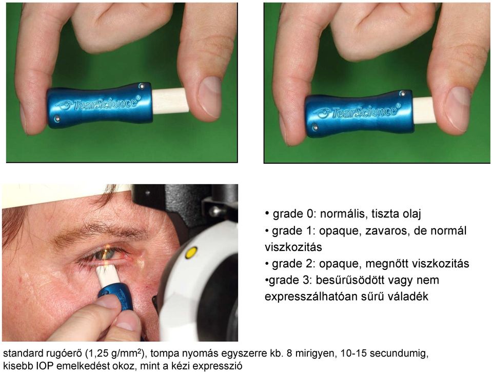 expresszálhatóan sűrű váladék standard rugóerő (1,25 g/mm 2 ), tompa nyomás