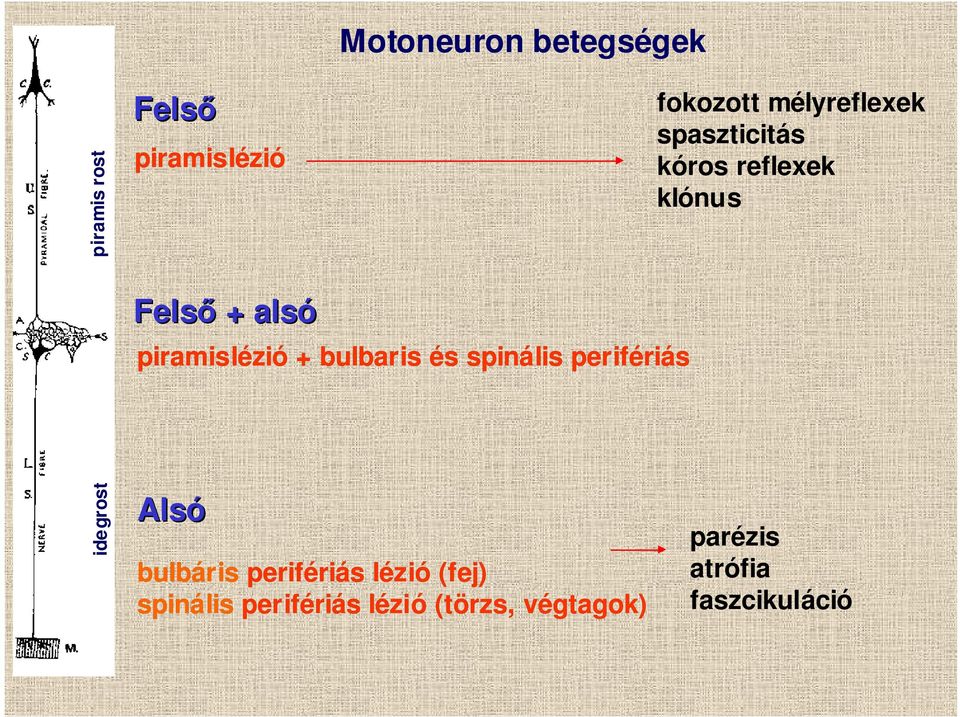 piramislézió + bulbaris és spinális perifériás idegrost Alsó bulbáris