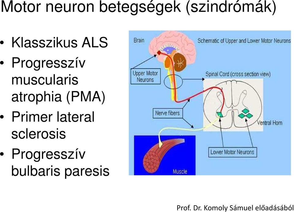 atrophia (PMA) Primer lateral sclerosis