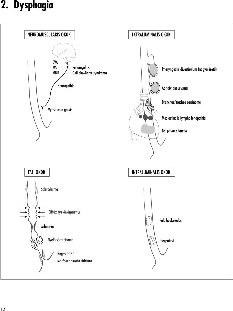 carcinoma Mediastinalis lymphadenopathia Bal pitvar dilatatio FALI OKOK INTRALUMINALIS OKOK Scleroderma