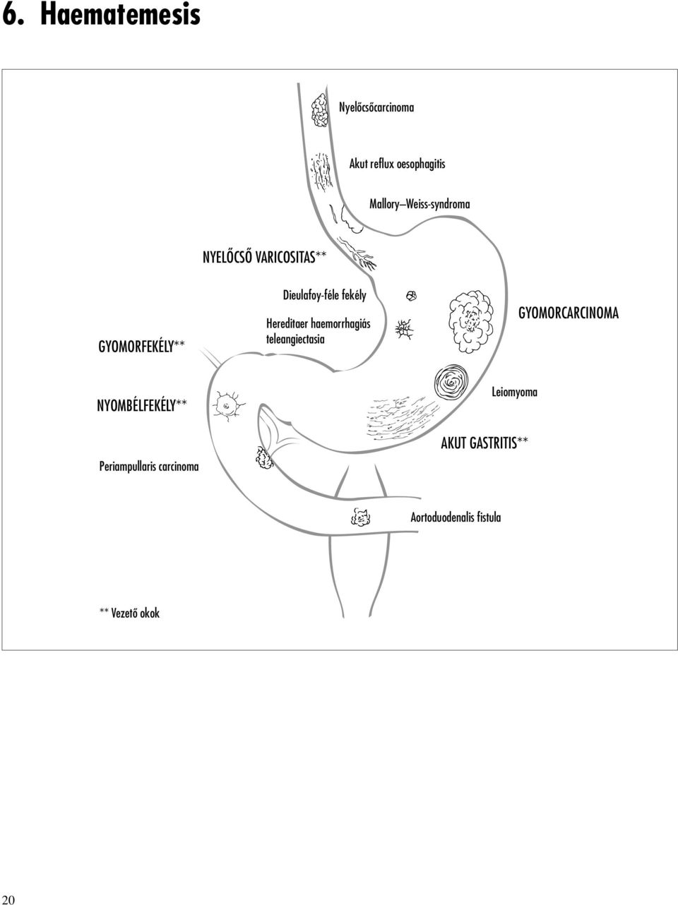 Hereditaer haemorrhagiás teleangiectasia GYOMORCARCINOMA NYOMBÉLFEKÉLY**