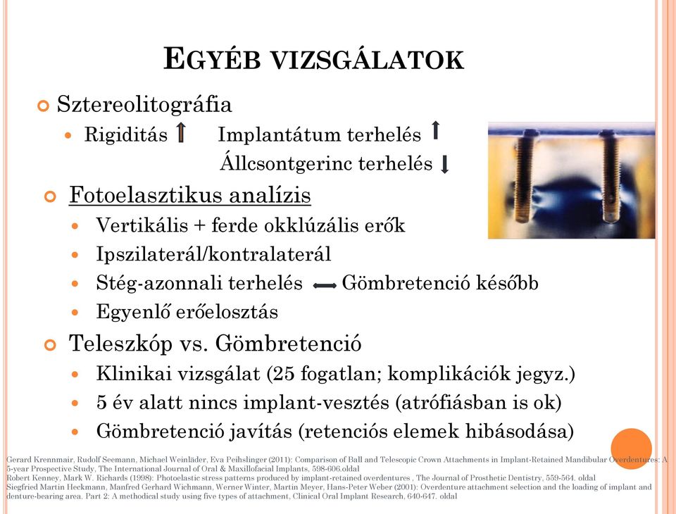 ) 5 év alatt nincs implant-vesztés (atrófiásban is ok) Gömbretenció javítás (retenciós elemek hibásodása) Gerard Krennmair, Rudolf Seemann, Michael Weinläder, Eva Peihslinger (2011): Comparison of