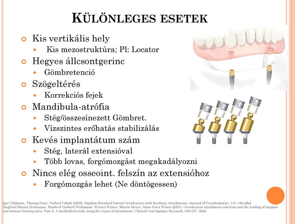 felszín az extensióhoz Forgómozgás lehet (Ne döntögessen) Igor Chikunov, Phuong Doan, Farhad Vahidi (2008): Implant-Retained Partial Overdenture with Resilient Attachments, Journal of Prosthodontics,