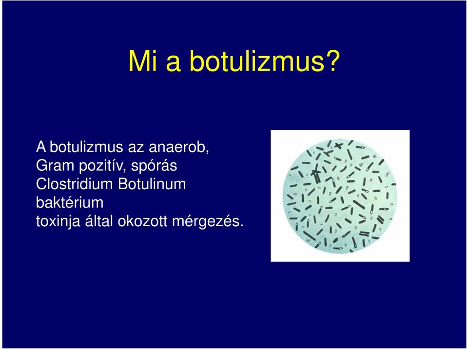 pozitív, spórás Clostridium