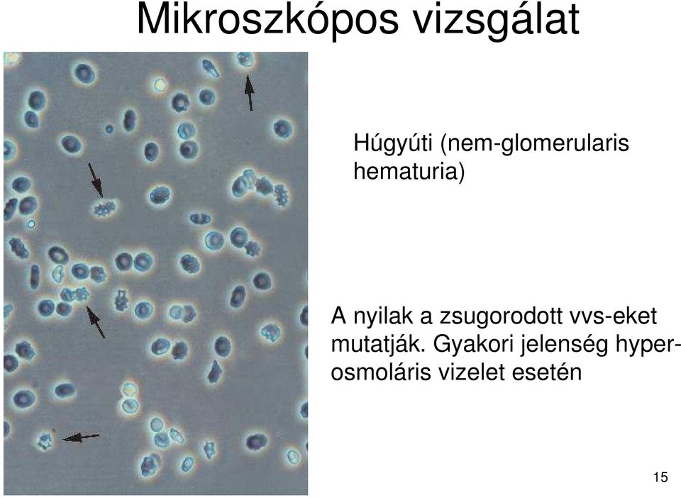 zsugorodott vvs-eket mutatják.