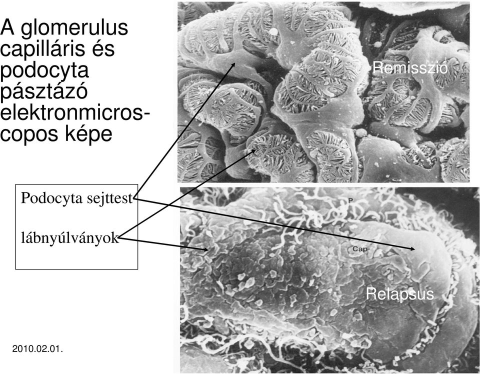 elektronmicroscopos képe