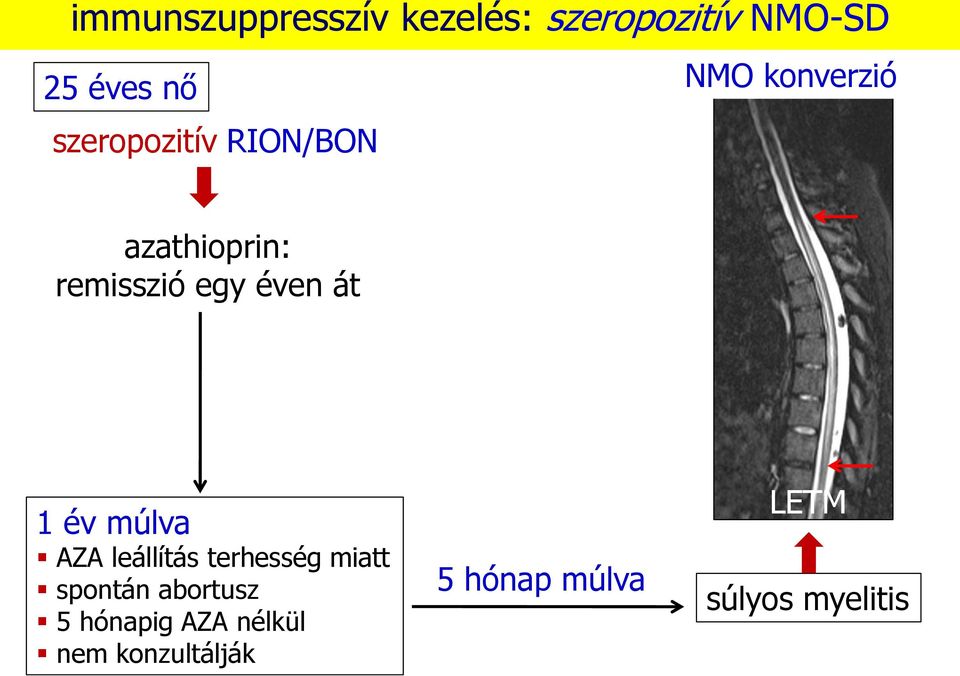 át 1 év múlva AZA leállítás terhesség miatt spontán abortusz 5