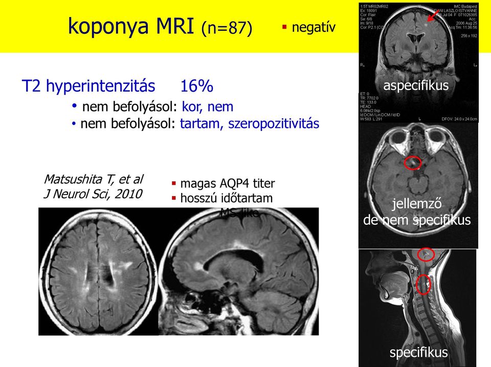 aspecifikus Matsushita T, et al J Neurol Sci, 2010 magas AQP4