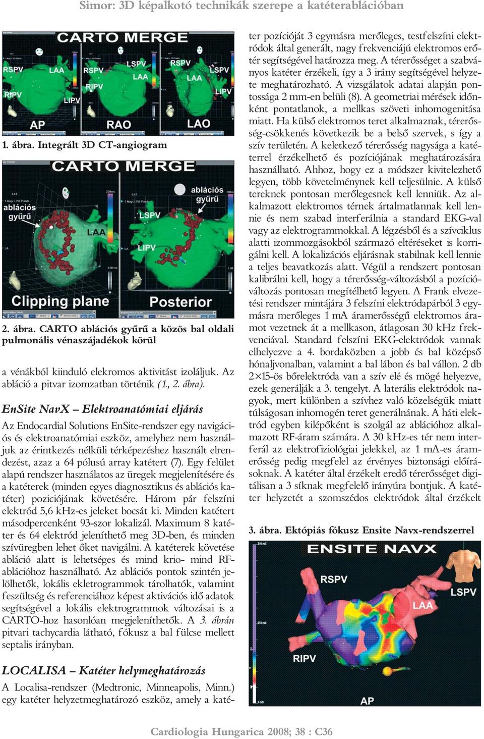 EnSite NavX Elektroanatómiai eljárás Az Endocardial Solutions EnSite-rendszer egy navigációs és elektroanatómiai eszköz, amelyhez nem használjuk az érintkezés nélküli térképezéshez használt