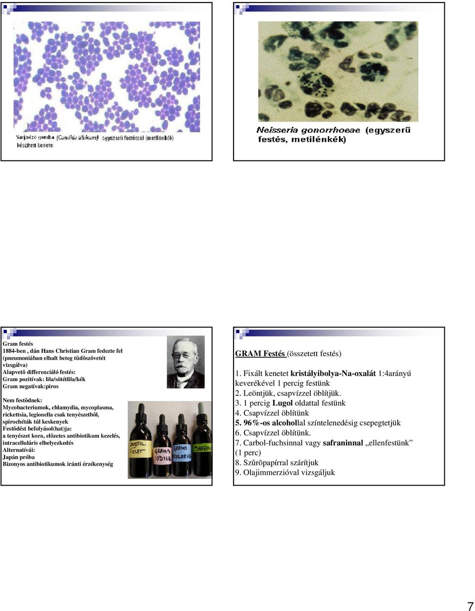 intracelluláris elhelyezkedés Alternatívái: Japán próba Bizonyos antibiotikumok iránti érzékenység GRAM Festés (összetett festés) 1.