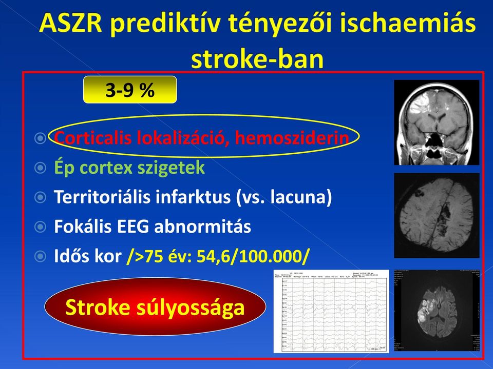 (vs. lacuna) Fokális EEG abnormitás Idős