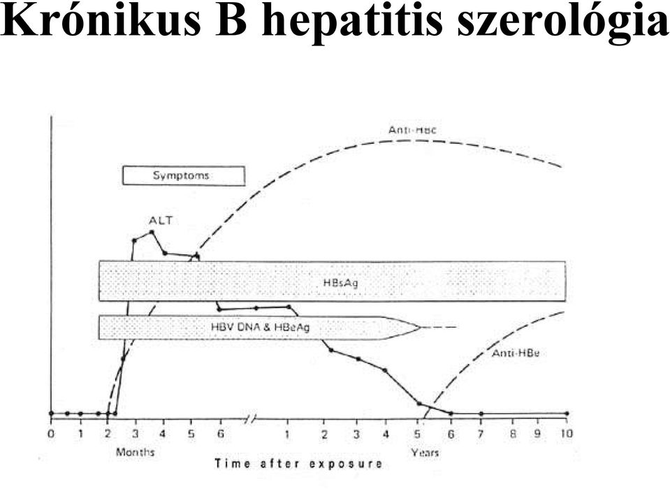 hepatitis