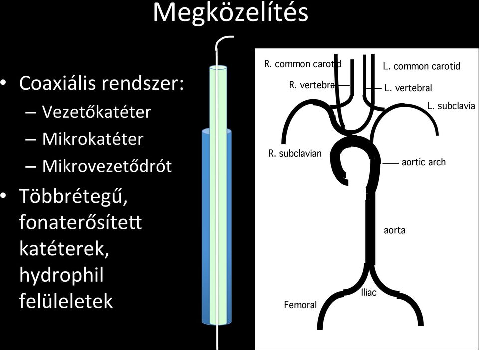 subclavian Mikrokatéter Mikrovezetődrót R.