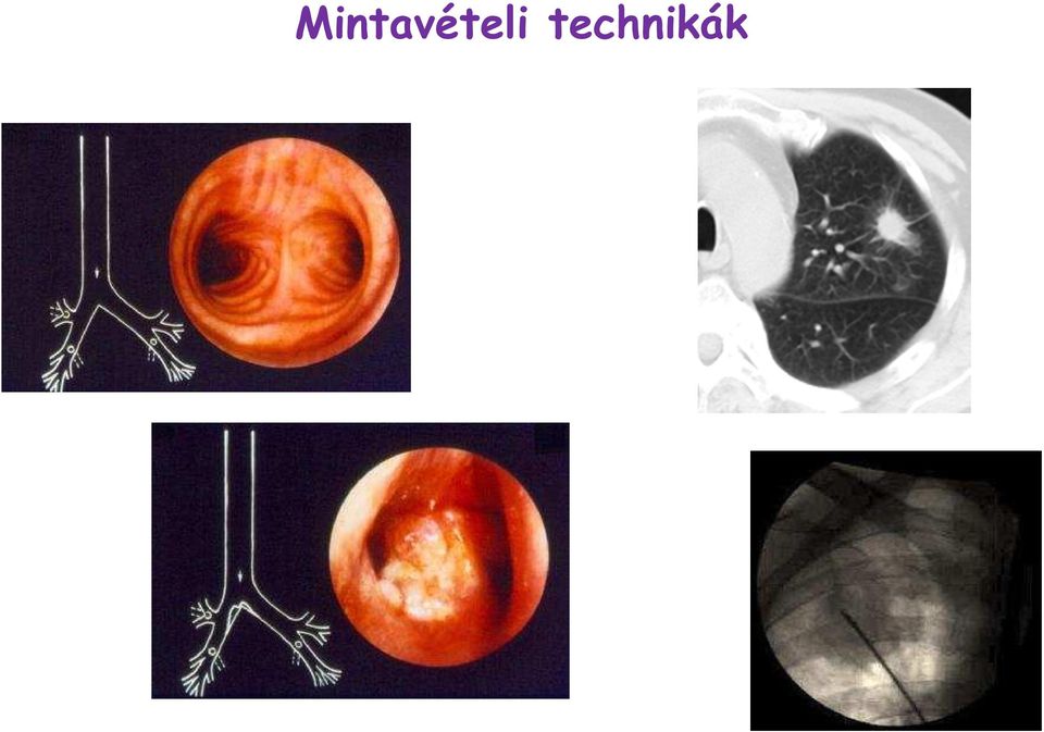 endoscopos kép Dr.