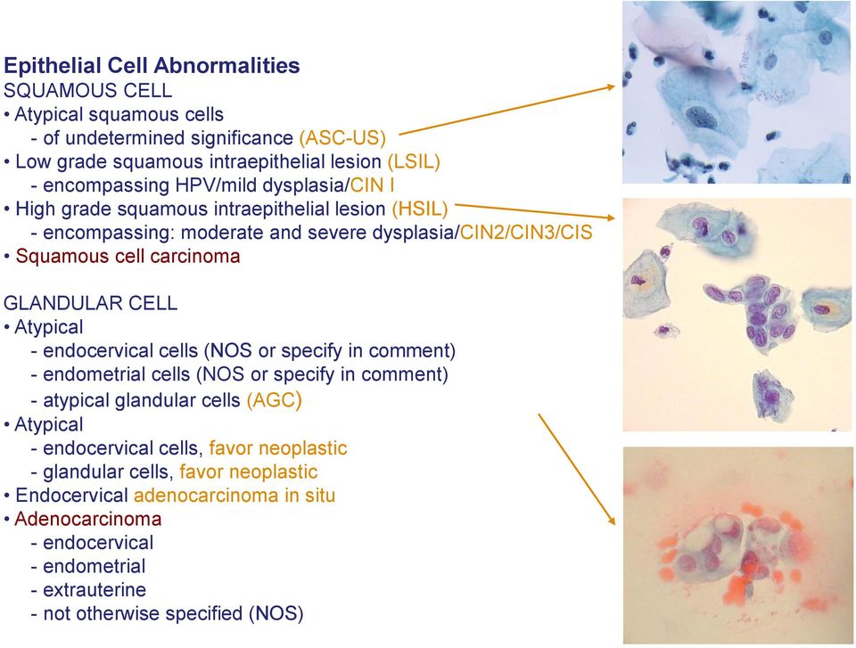 Atypical - endocervical cells (NOS or specify in comment) - endometrial cells (NOS or specify in comment) - atypical glandular cells (AGC) Atypical - endocervical cells,