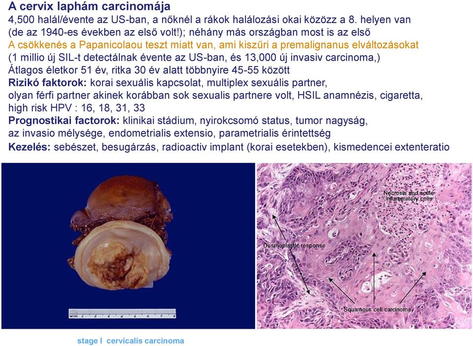 carcinoma,) Átlagos életkor 51 év, ritka 30 év alatt többnyire 45-55 között Rizikó faktorok: korai sexuális kapcsolat, multiplex sexuális partner, olyan férfi partner akinek korábban sok sexualis