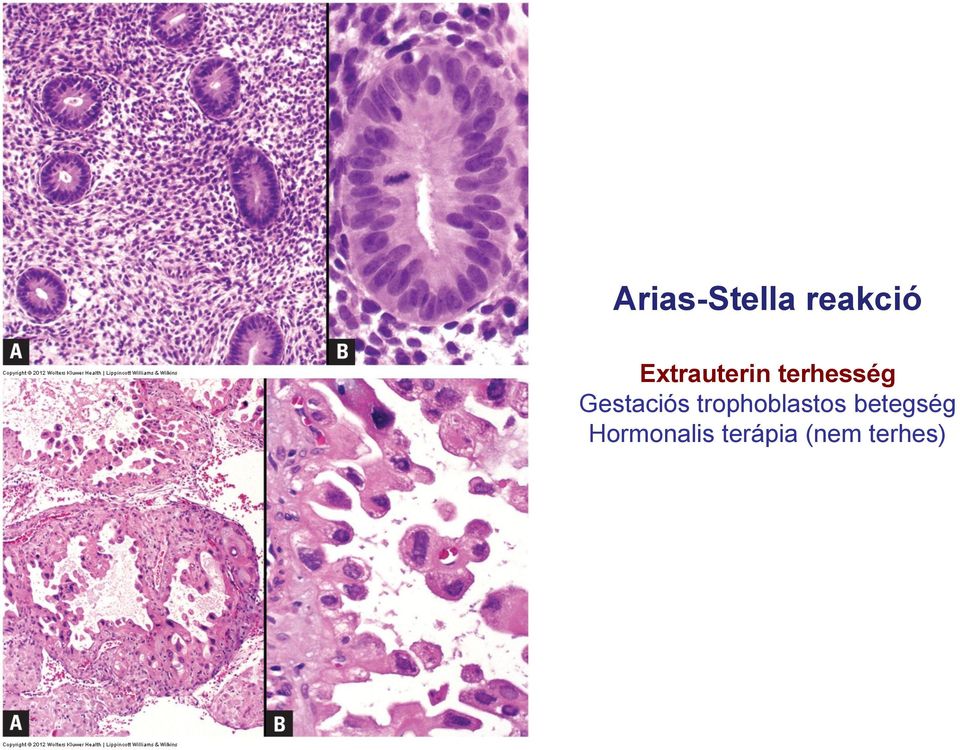 Gestaciós trophoblastos