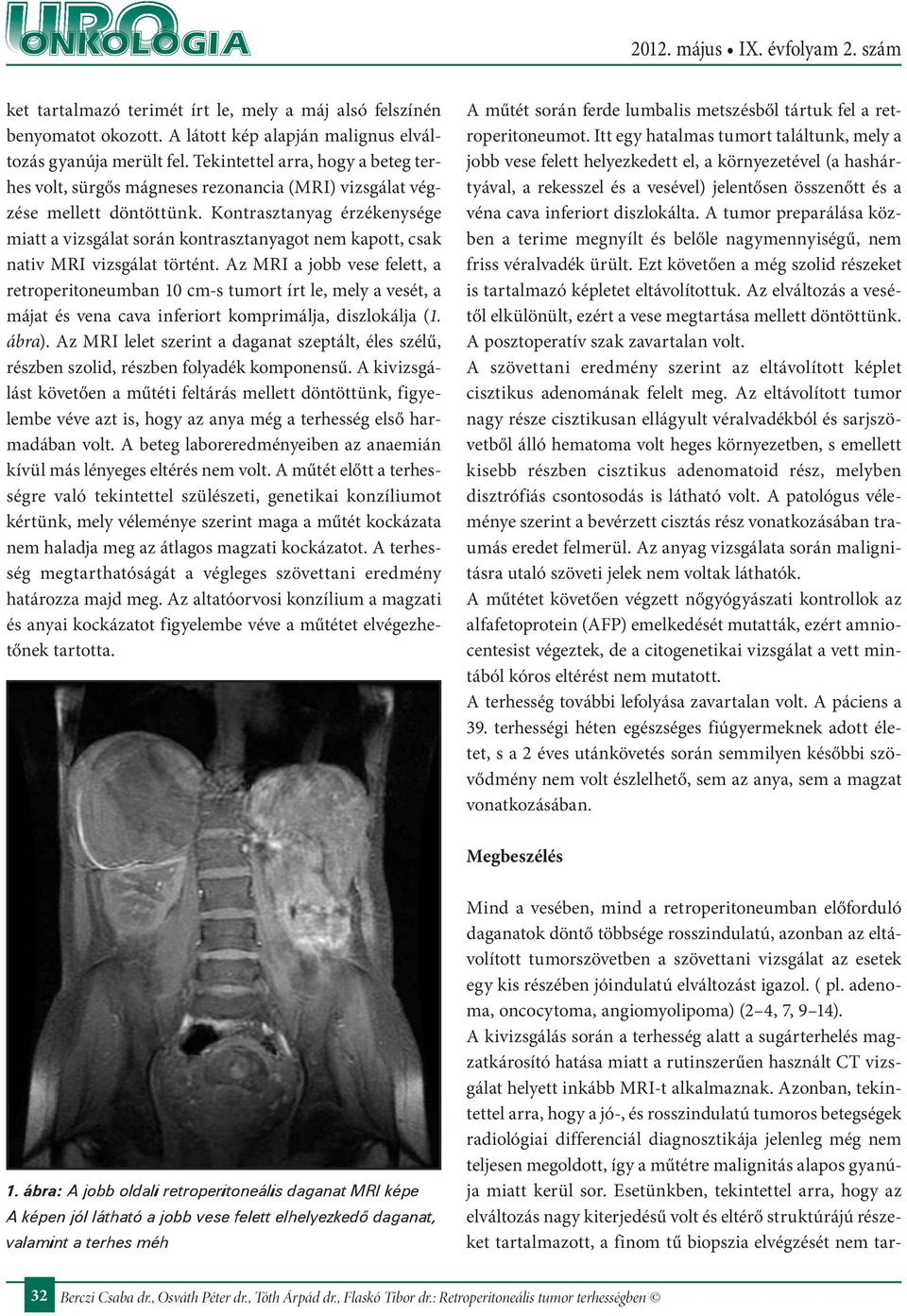 Kontrasztanyag érzékenysége miatt a vizsgálat során kontrasztanyagot nem kapott, csak nativ MRI vizsgálat történt.