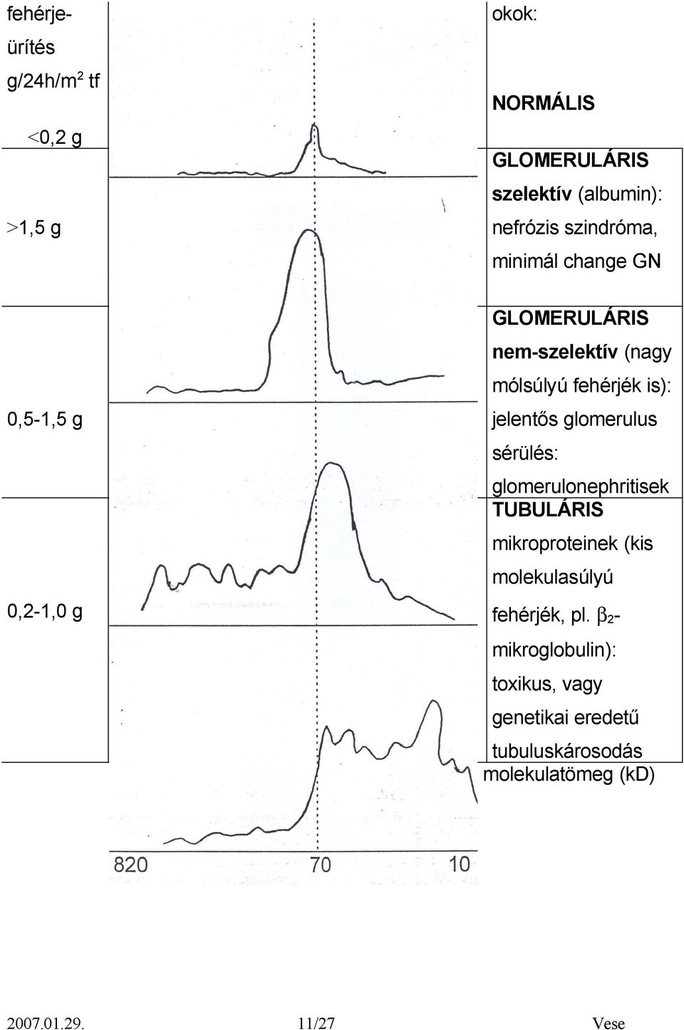 glomerulus sérülés: glomerulonephritisek TUBULÁRIS mikroproteinek (kis molekulasúlyú 0,2-1,0 g