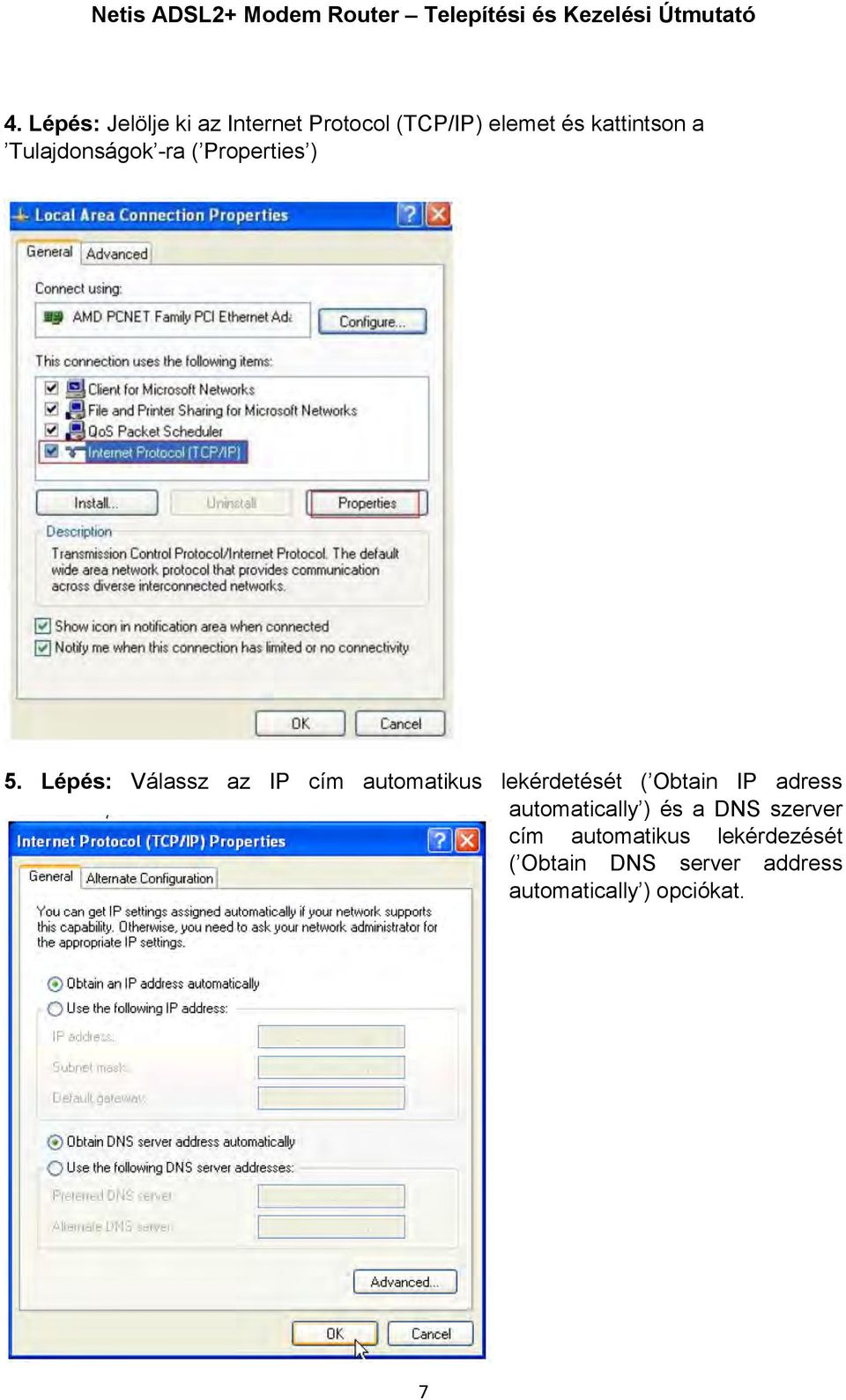 Lépés: Válassz az IP cím automatikus lekérdetését ( Obtain IP adress